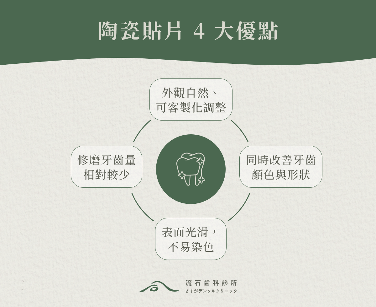 陶瓷貼片 4 大優點