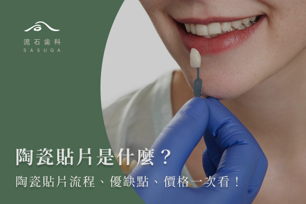 陶瓷貼片是什麼?陶瓷貼片流程、優缺點、價格一次看!