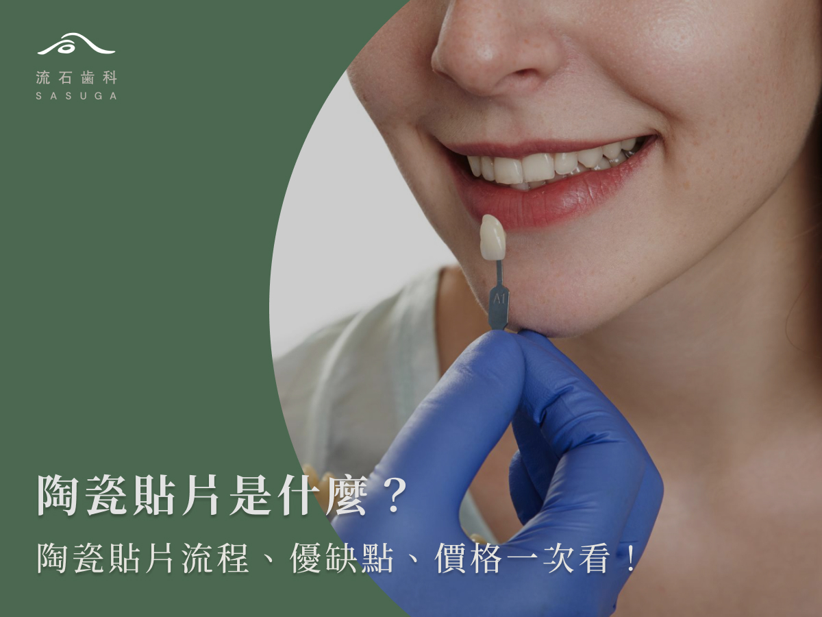 陶瓷貼片是什麼?陶瓷貼片流程、優缺點、價格一次看!