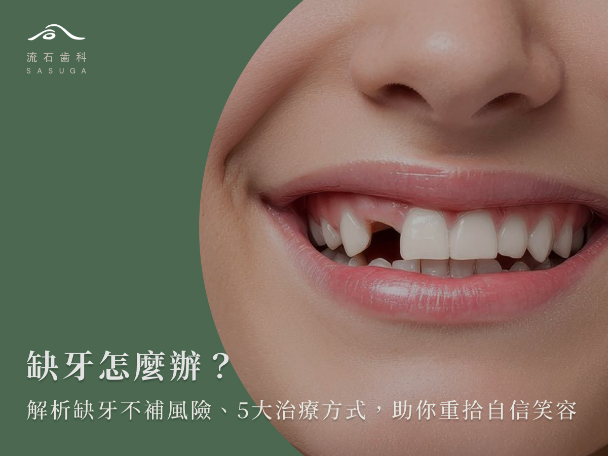 缺牙怎麼辦?解析缺牙不補風險、5大治療方式,助你重拾自信笑容